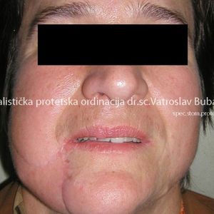 Oral Surgery 2