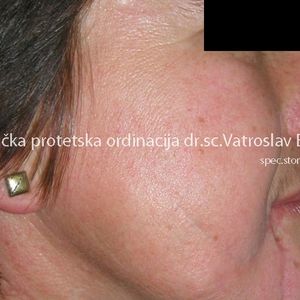 Oral Surgery 3