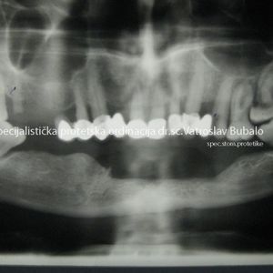 Oral Surgery 4