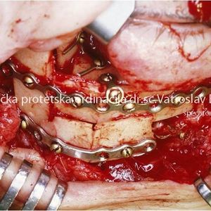 Oral Surgery 5