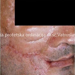 Oral Surgery 6