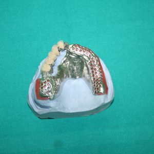 Combination Prosthetics 7