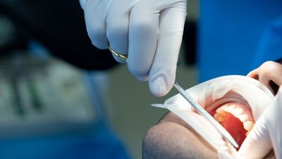 Oral Surgery