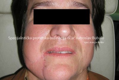 Die anspruchsvollsten Fälle 2